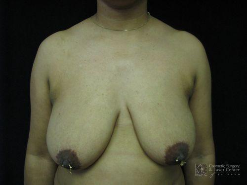 photo_gallery_before556case_1.jpg