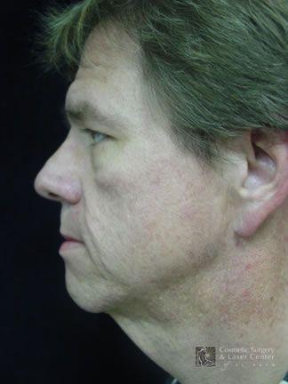 photo_gallery_before604case_1.jpg