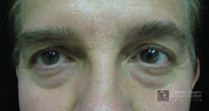 photo_gallery_before606case_1.jpg