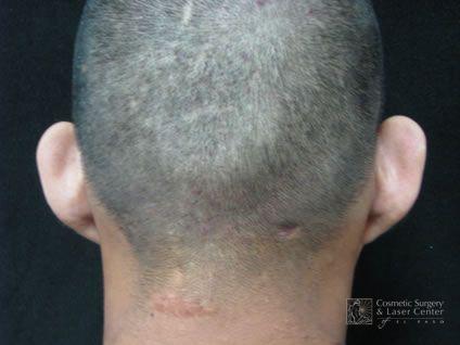 photo_gallery_before608case_1.jpg