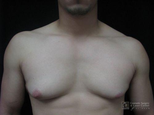 photo_gallery_before610case_1.jpg