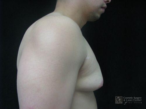 photo_gallery_before610case_2.jpg