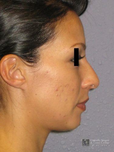 photo_gallery_before627case_1.jpg