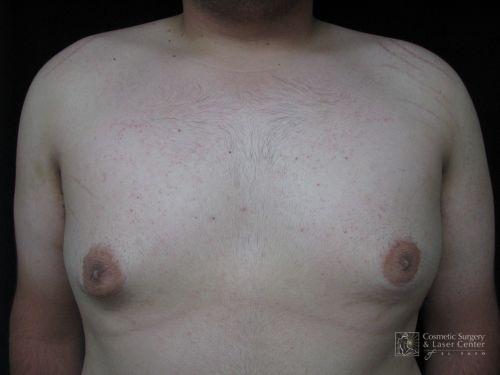 photo_gallery_before632case_2.jpg