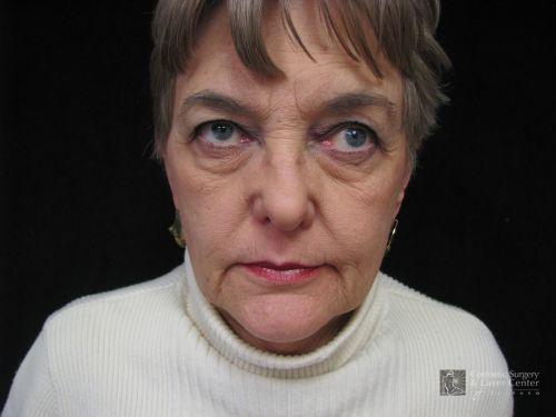 photo_gallery_before637case_3.jpg