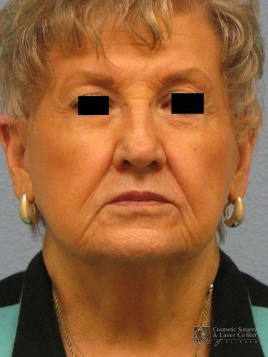 photo_gallery_before641case_3.jpg