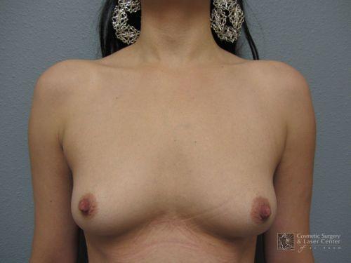 photo_gallery_before661case_1.jpg