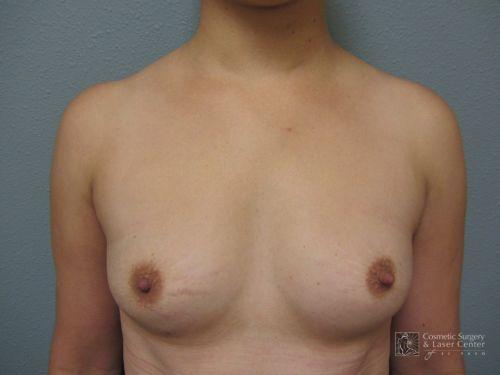 photo_gallery_before662case_1.jpg