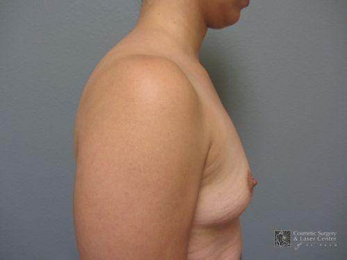 photo_gallery_before662case_2.jpg