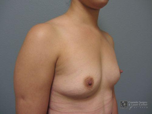photo_gallery_before662case_3.jpg