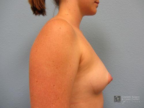 photo_gallery_before668case_2.jpg