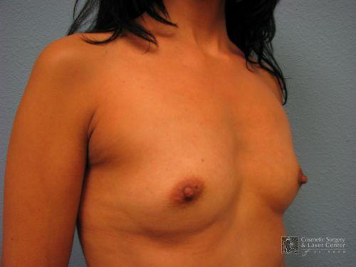 photo_gallery_before670case_3.jpg