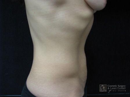 photo_gallery_before707case_2.jpg