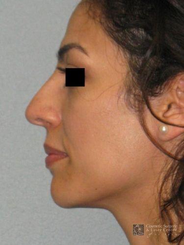 photo_gallery_before713case_1.jpg