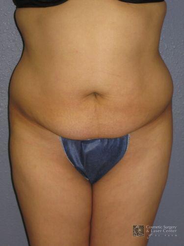 photo_gallery_before758case_1.jpg