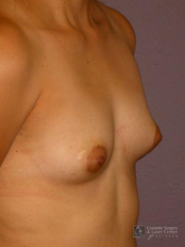 photo_gallery_before781case_2.jpg