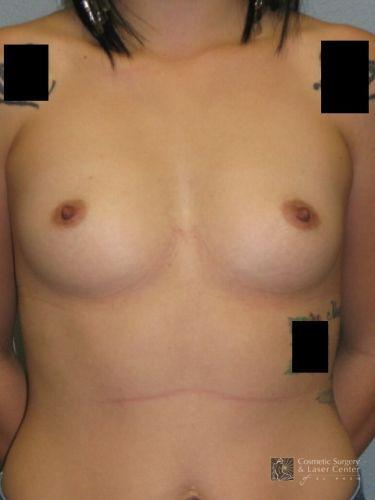 photo_gallery_before790case_1.jpg