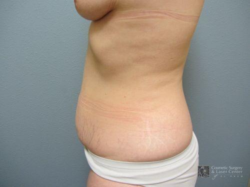 photo_gallery_before815case_3.jpg