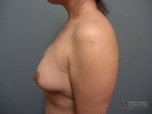 photo_gallery_before826case_2.jpg