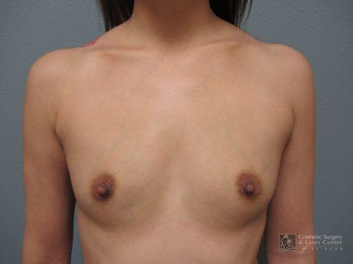 photo_gallery_before832case_1.jpg