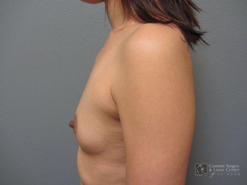 photo_gallery_before832case_2.jpg