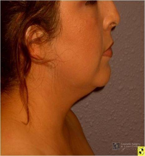 photo_gallery_before838case_1.jpg