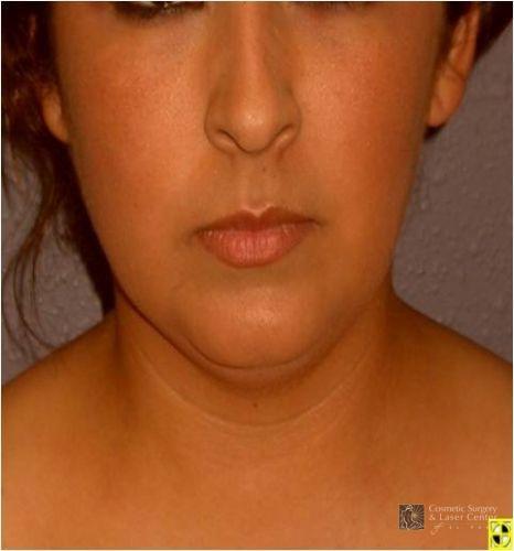 photo_gallery_before838case_2.jpg
