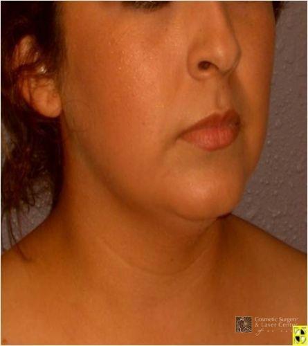 photo_gallery_before838case_3.jpg