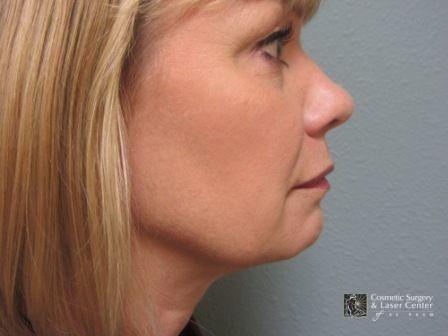 photo_gallery_before867case_1.jpg