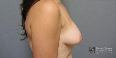 photo_gallery_before885case_2.jpg