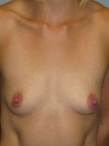 photo_gallery_before903case_1.jpg
