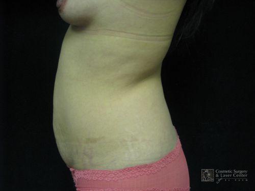 photo_gallery_before906case_2.jpg