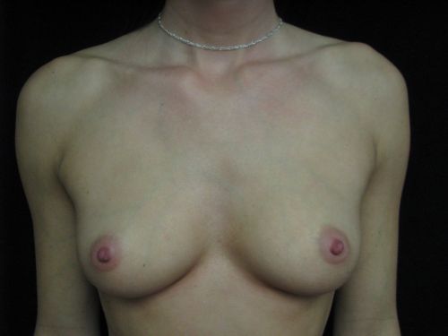 photo_gallery_before915case_1.jpg