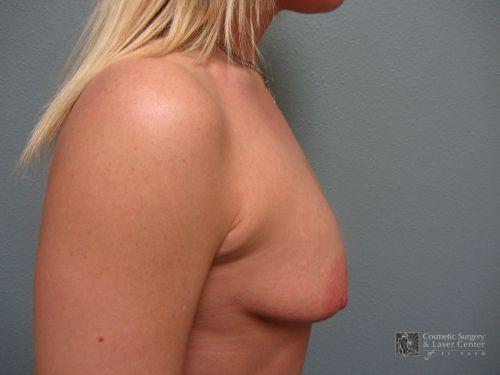 photo_gallery_before927case_2.jpg