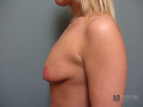 photo_gallery_before927case_3.jpg