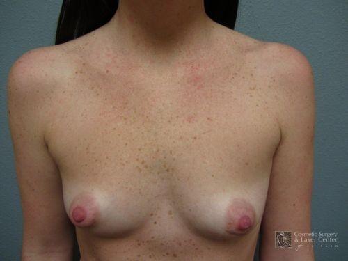 photo_gallery_before933case_1.jpg