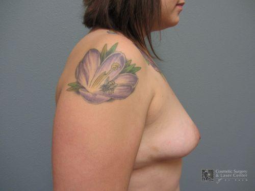 photo_gallery_before936case_2.jpg