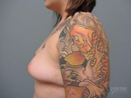 photo_gallery_before936case_3.jpg