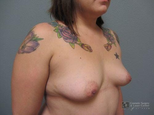photo_gallery_before936case_4.jpg
