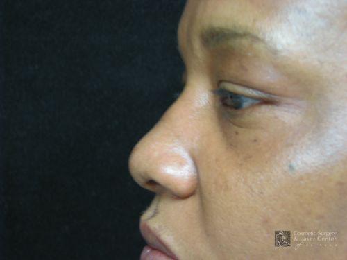 photo_gallery_before941case_3.jpg