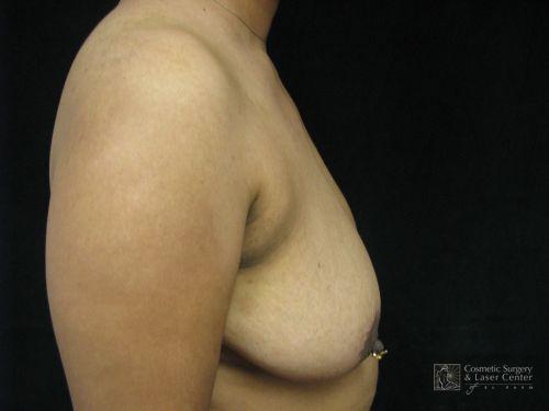photo_gallery_before944case_2.jpg
