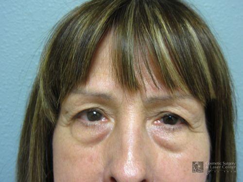 photo_gallery_before945case_1.jpg