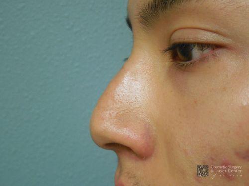 photo_gallery_before972case_1.jpg