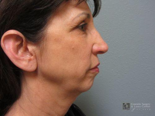 photo_gallery_before976case_1.jpg