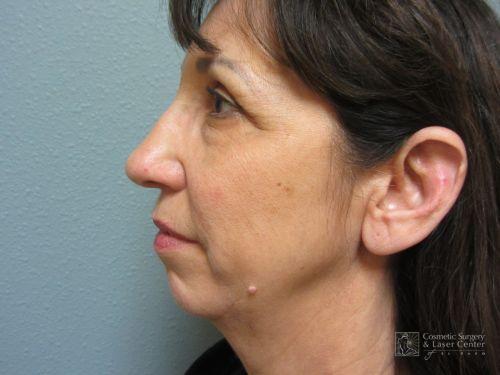 photo_gallery_before976case_2.jpg