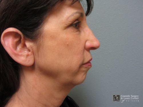 photo_gallery_before978case_1.jpg