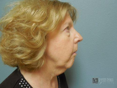 photo_gallery_before979case_1.jpg