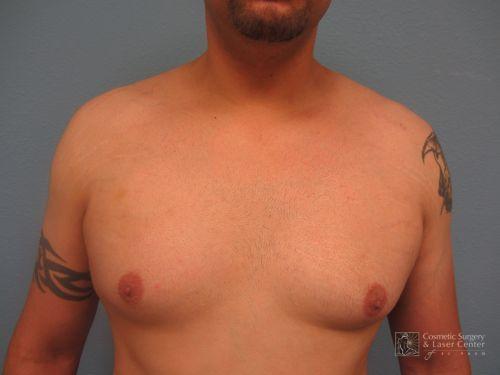 photo_gallery_before992case_1.jpg