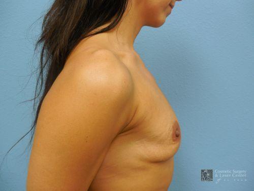 photo_gallery_before994case_2.jpg