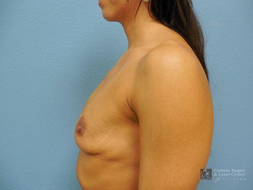 photo_gallery_before994case_3.jpg